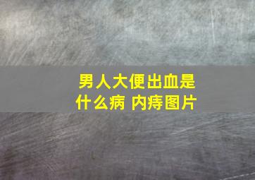 男人大便出血是什么病 内痔图片